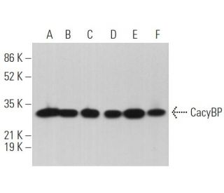 CacyBP Antibody (H-1) - Western Blotting - Image 362280 