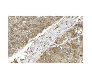CAD Antibody (H-1) - Immunohistochemistry - Image 13264 