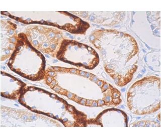 cadherin-16 Antibody (H-10) - Immunohistochemistry - Image 386818 