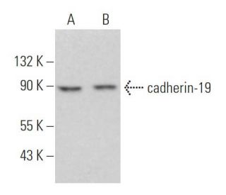cadherin-19 Antibody (D-1) - Western Blotting - Image 365920 