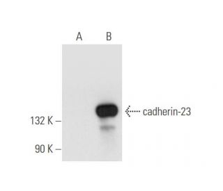 cadherin-23 Antibody (A-5) - Western Blotting - Image 65971