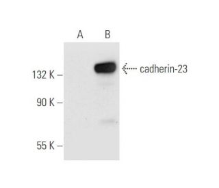 cadherin-23 Antibody (H-7) - Western Blotting - Image 65969 