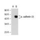 cadherin-23 Antibody (H-7) - Western Blotting - Image 126991