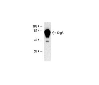 western blotting image from recommended CagA (A-10) monoclonal antibody replacement. Image 9535