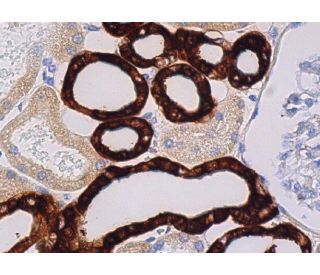 immunohistochemistry image from recommended Calbindin D28K (D-4) monoclonal antibody replacement. Image 363389