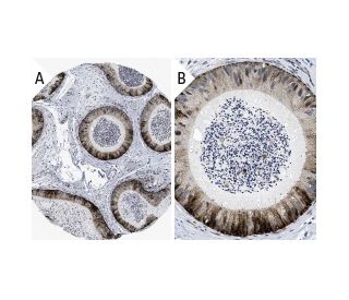 immunohistochemistry image from recommended Calbindin D9K (D-5) monoclonal antibody replacement. Image 31598