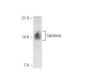 Calcitonin Antibody (13f2) - Western Blotting - Image 65783