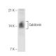 Calcitonin Antibody (13f2) - Western Blotting - Image 65783