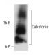 Calcitonin Antibody (14A2) - Western Blotting - Image 12684