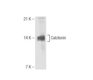 Calcitonin Antibody (14A2) - Western Blotting - Image 65785 