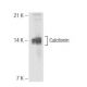 Calcitonin Antibody (14A2) - Western Blotting - Image 65785 