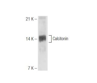 Calcitonin Antibody (16B5) - Western Blotting - Image 65787