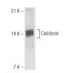 Calcitonin Antibody (16B5) - Western Blotting - Image 65787