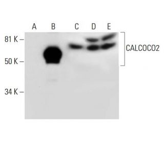 CALCOCO2 Antibody (C-9) - Western Blotting - Image 291976