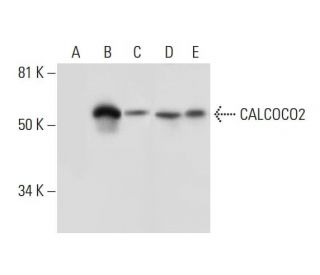 CALCOCO2 Antibody (E-10) - Western Blotting - Image 291900 