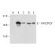 CALCOCO2 Antibody (E-10) - Western Blotting - Image 291900 