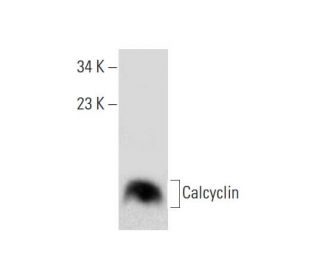western blotting image from recommended Calcyclin (F-1) monoclonal antibody replacement. Image 136979