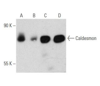 western blotting image from recommended Caldesmon (C21) monoclonal antibody replacement. Image 358445
