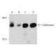 This polyclonal antibody has been discontinued. See our recommended <a href="caldesmon-antibody-c21">Caldesmon (C21)</a> monoclonal antibody (sample data shown). western blotting image from recommended Caldesmon (C21) monoclonal antibody replacement. Image 358445