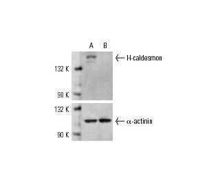 caldesmon siRNA (h): sc-29880. Western blot analysis of H-caldesmon expression in non-transfected control (A) and caldesmo 