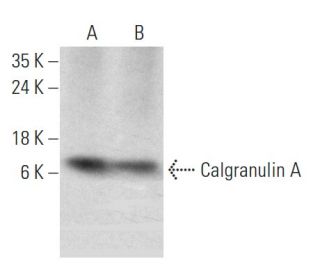 western blotting image from recommended Calgranulin A (C-10) monoclonal antibody replacement. Image 353693