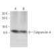 western blotting image from recommended Calgranulin A (C-10) monoclonal antibody replacement. Image 353693