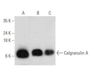 Calgranulin A Antibody (MRP8 2C5/4) - Western Blotting - Image 353689 