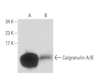 Calgranulin A/B Antibody (5.5) - Western Blotting - Image 16158