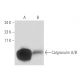 Calgranulin A/B Antibody (5.5) - Western Blotting - Image 16158