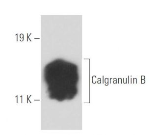 Calgranulin B Antibody (47-8D3) - Western Blotting - Image 15772