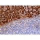 이 다클론 항체는 생산이 중단되었습니다. 권장 <a href="calgranulin-b-antibody-b-5">Calgranulin B (B-5)</a> 단클론 항체(샘플 데이터 표시)를 참조하세요. immunohistochemistry image from recommended Calgranulin B (B-5) monoclonal antibody replacement. Image 370153