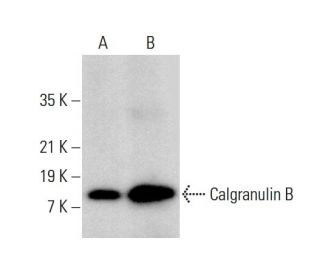 Calgranulin B Antibody (F-4) - Western Blotting - Image 378762 