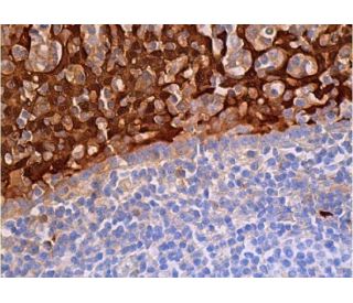 immunohistochemistry image from recommended Calgranulin B (B-5) monoclonal antibody replacement. Image 370153
