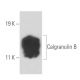 western blotting image from recommended Calgranulin B (47-8D3) monoclonal antibody replacement. Image 15772