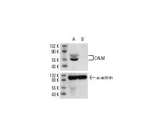 CALM siRNA (h): sc-29882. Western blot analysis of CALM expression in non-transfected control (A) and CALM siRNA transfect 
