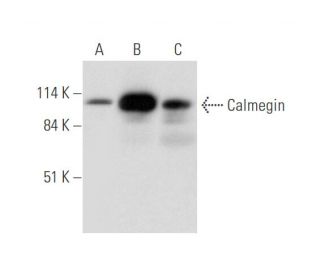 Calmegin Antibody (B-11) - Western Blotting - Image 344628 