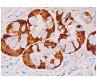 CALML5 Antibody (A-3) - Immunohistochemistry - Image 346191 