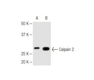Calpain 1/2 Antibody (28F3) - Western Blotting - Image 67296