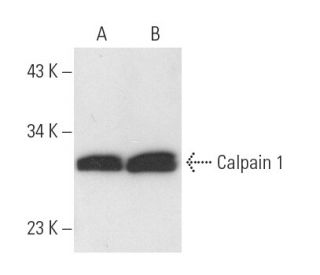 Calpain 1 Antibody (5B3) - Western Blotting - Image 11094 