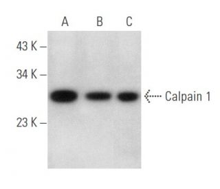 Calpain 1 Antibody (5B3) - Western Blotting - Image 357402 