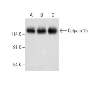 Calpain 15 Antibody (D-5) - Western Blotting - Image 320223SAM Transcription Activation: SAM system utilizing dCas9-VP64, MS2-P65-HSF1, and sgRNA for precise gene transcription activation.