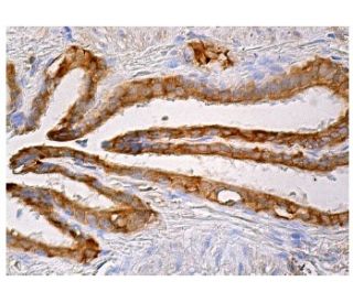 immunohistochemistry image from recommended Calpain 2 (E-10) monoclonal antibody replacement. Image 159587
