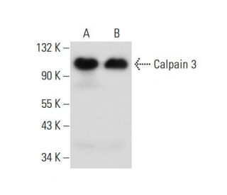 Calpain 3 Antibody (E-6) - Western Blotting - Image 138941