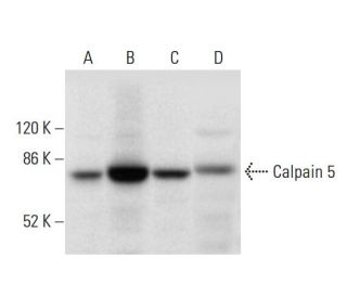 Calpain 5 Antibody (A-5) - Western Blotting - Image 305709 