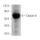 Calpain 6 Antibody (1395CT446.22.5) - Western Blotting - Image 374603