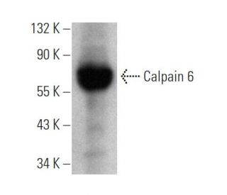 Calpain 6 Antibody (1395CT446.22.5) - Western Blotting - Image 374603The Double Nickase Plasmid features a U6 promoter for sgRNA expression, a 20 nt targeting sequence, and a gRNA scaffold to guide Cas9n. It includes a CBh promoter for Cas9n (D10A) and puromycin resistance, GFP for transfection verification, and nuclear localization signals (NLS). The 2A peptide allows co-expression of Cas9n and Puro from a single promoter, enabling precise genome editing with reduced off-target effects. 