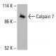 Calpain 7 Antibody (F-10) - Western Blotting - Image 416033
