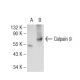 Calpain 9 Antibody (E-6) - Western Blotting - Image 108844 