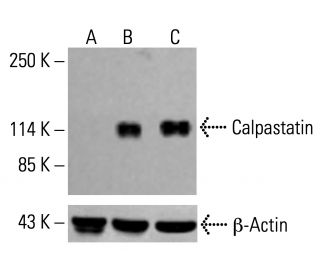 Calpastatin Antibody (2Q31) - Western Blotting - Image 413237 