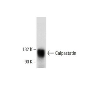 western blotting image from recommended Calpastatin (A-1) monoclonal antibody replacement. Image 289781